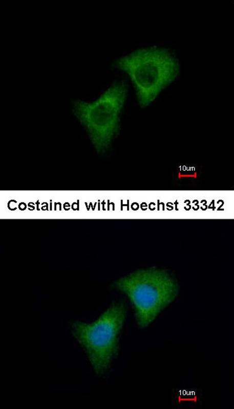 Dkk-3 antibody