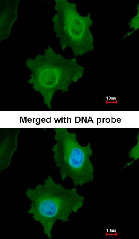 Caspase 14 antibody