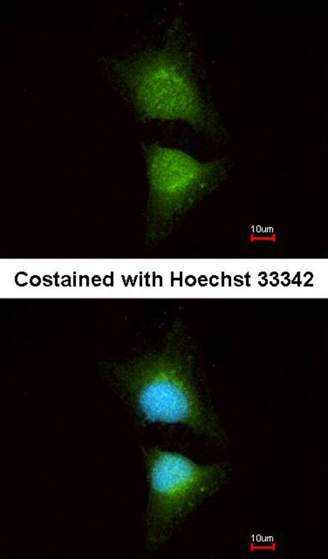 PI3 Kinase p110 beta antibody