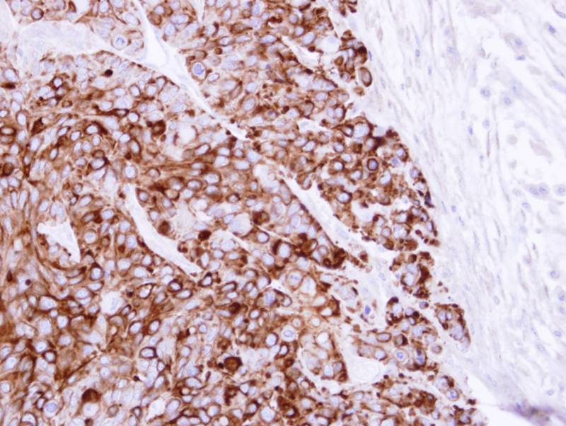 Cytokeratin 20 antibody