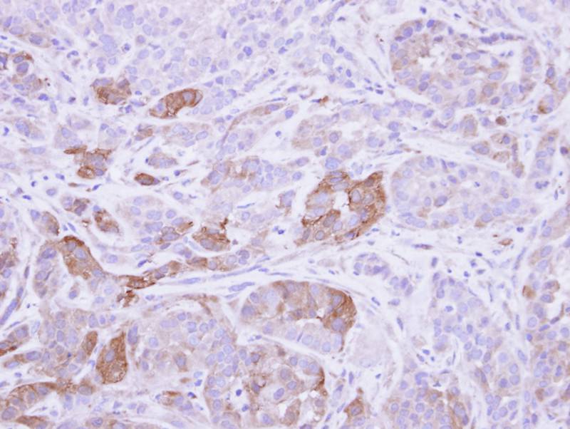 Villin antibody