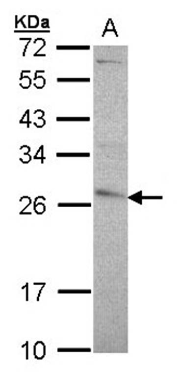 glutathione transferase antibody