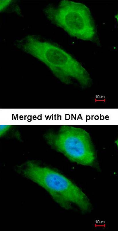 NQO1 antibody - SAB | Signalway Antibody