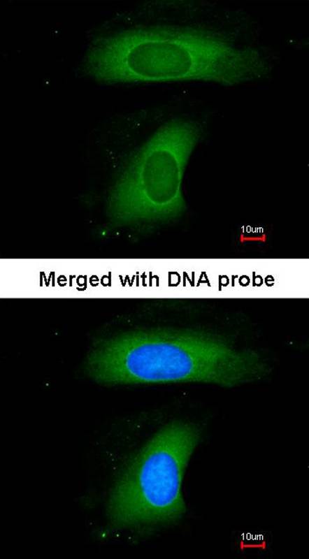 B-cell linker protein antibody
