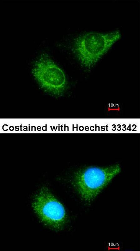 caspase-8 antibody