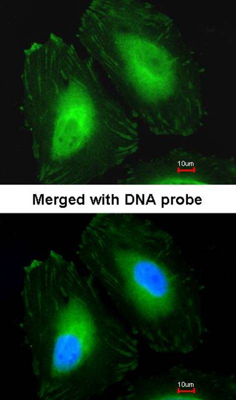 Beta-crystallin A4 antibody