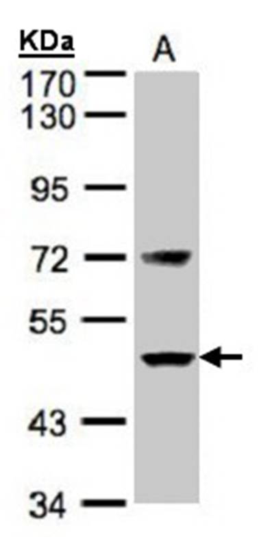 Factor VII antibody - SAB | Signalway Antibody