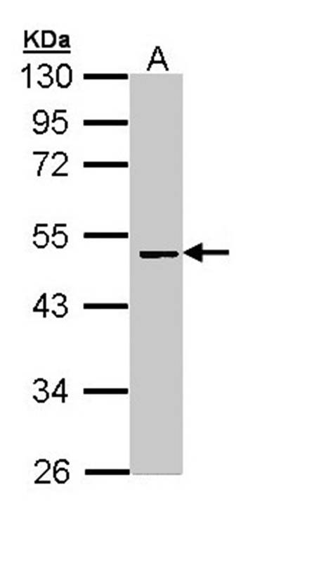 Factor X antibody - SAB | Signalway Antibody