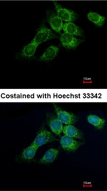 17beta-HSD4 antibody
