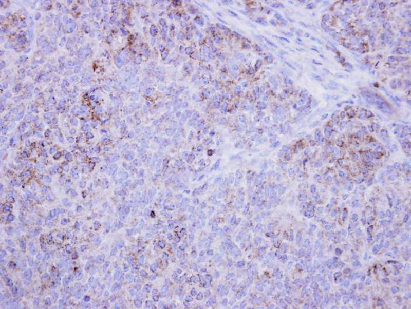 17beta-HSD4 antibody