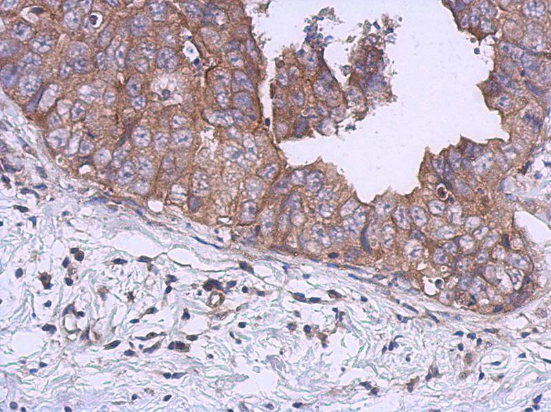 UKHC antibody