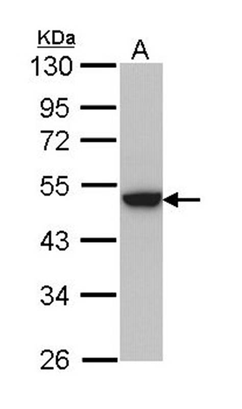 keratin 31 antibody