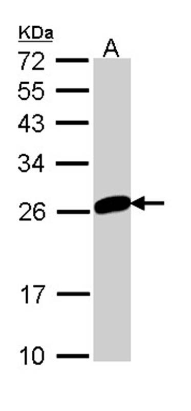 MAD2 antibody