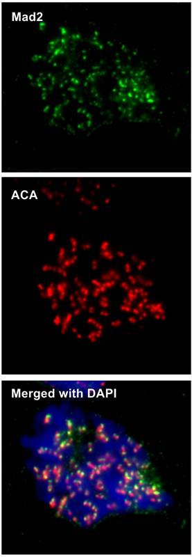 MAD2 antibody