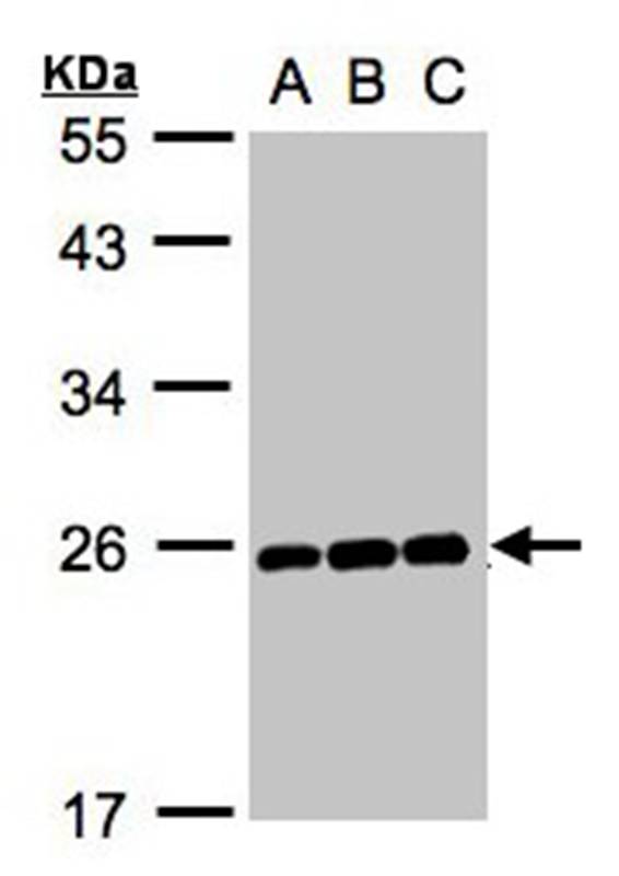 MAD2 antibody