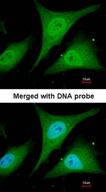 I kappa B-alpha antibody