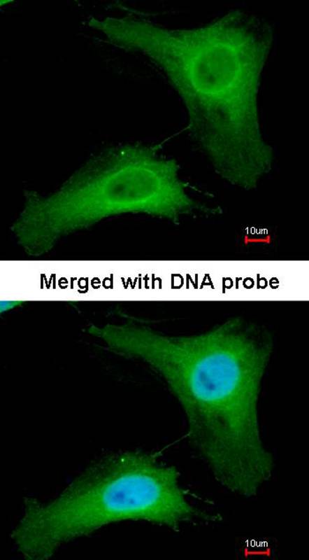 PHLP antibody