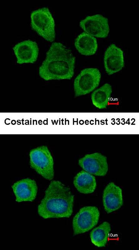 PTGFRN antibody