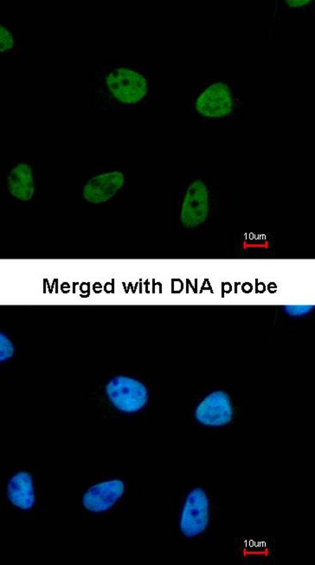 RPA 32 kDa subunit antibody