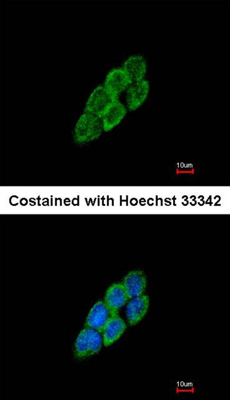 LTBP-4 antibody