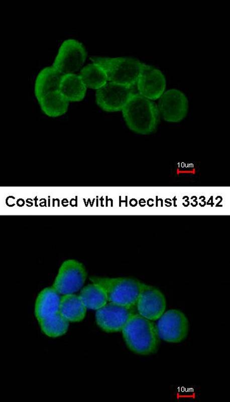 FLRT1 antibody