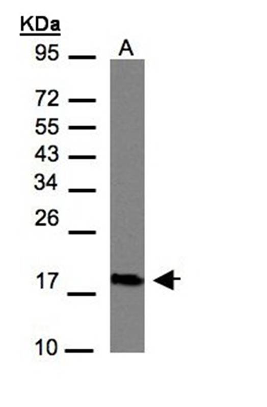 CMTM6 antibody