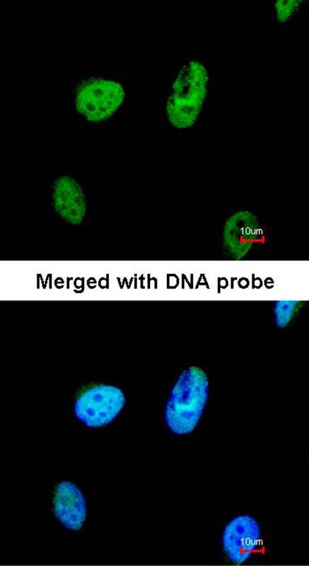 TATDN1 antibody