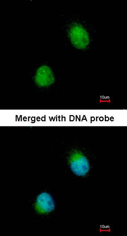 ZC3H8 antibody