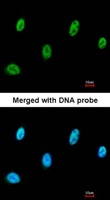 SESN3 antibody