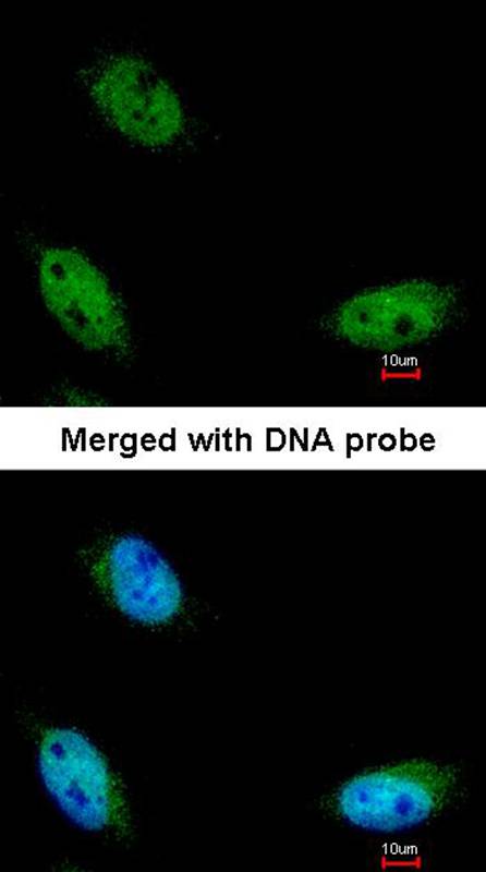 NSUN6 antibody