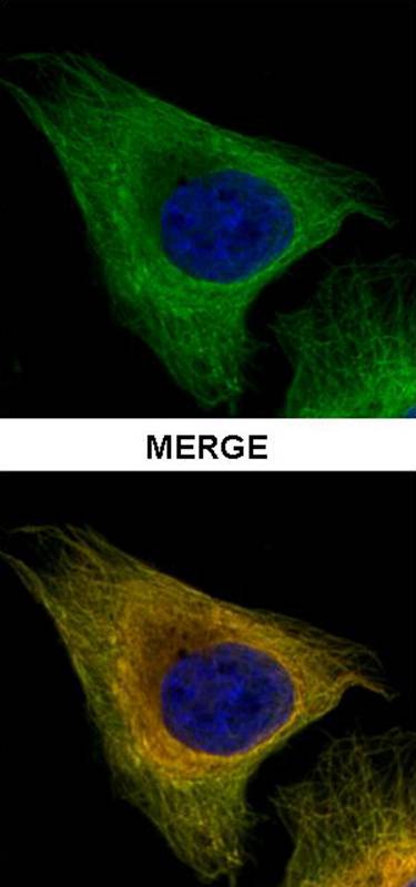 Tubulin beta-8 antibody