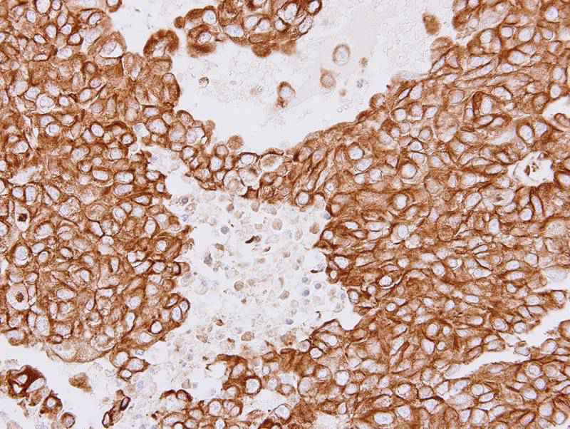 Tubulin beta-8 antibody