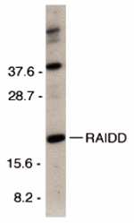 RAIDD Antibody