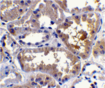 RAIDD Antibody