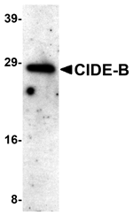 CIDE-B Antibody