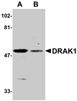 DRAK1 Antibody