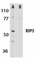 RIP3 Antibody