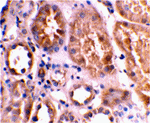 Bnip3L Antibody