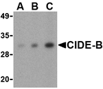 CIDE-B Antibody