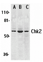 Chk2 Antibody