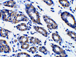 Noxa Antibody