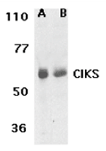 CIKS Antibody