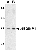 p53DINP1 Antibody