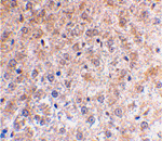 p53DINP1 Antibody