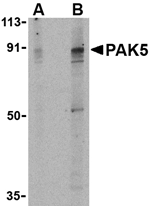 PAK5 Antibody