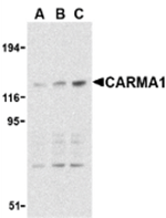 CARMA1 Antibody