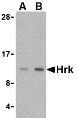 Hrk Antibody