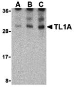 TL1A Antibody