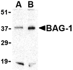 BAG-1 Antibody