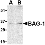 BAG-1 Antibody